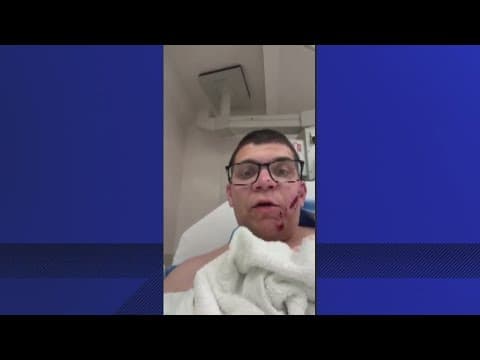 Man was returning home from chemotherapy when shot at on I-70 in Columbus