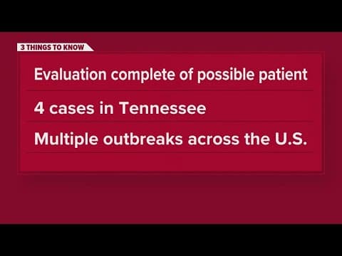 No confirmed measles cases in Knox County, health department says