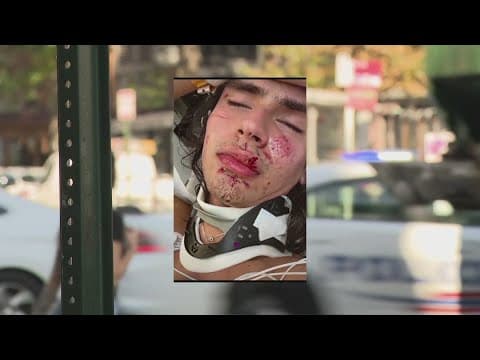 Man assaulted by group yelling homophobic slurs on U Street