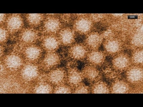 Norovirus cases: Latest updates on stomach bug