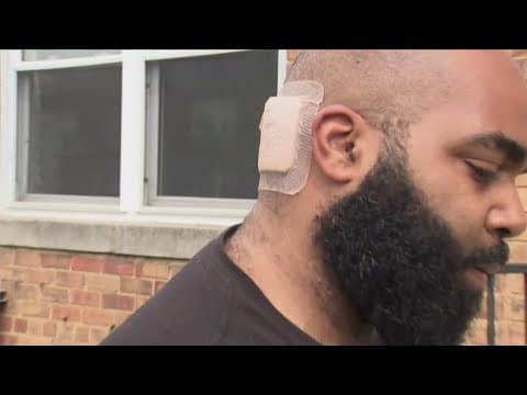 “This dude just came at me with a knife" | 6 Northeast DC stabbing victims in recovery