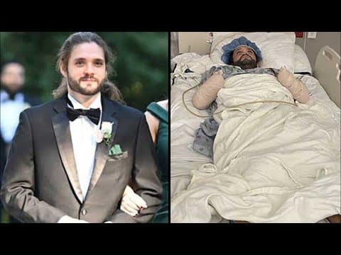 Houston man lost both hands and his toes. It may have started with a flea bite.