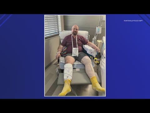 Huntsville police officer 'doing well' after being shot at apartment complex