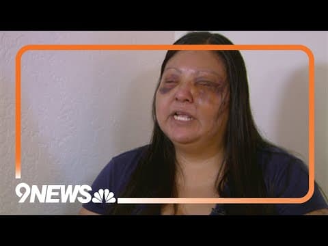 Indigenous woman recovering from domestic violence attack