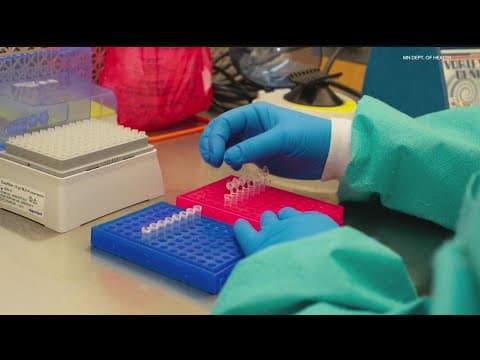 Minnesota becomes first state to screen newborns for CMV