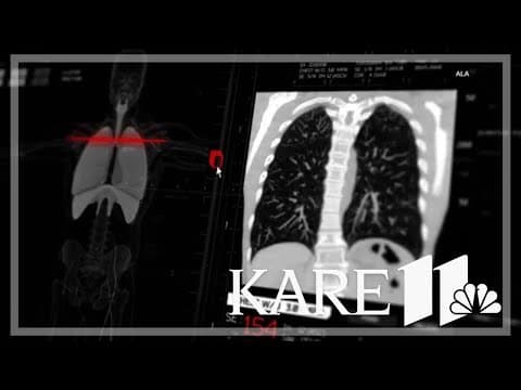 World Cancer Day shines light on lung cancer