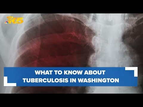 What to know about tuberculosis in Washington