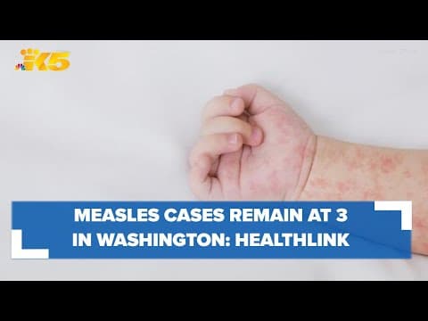Measles cases remain at 3 in WA amid rising nationwide cases: HealthLink