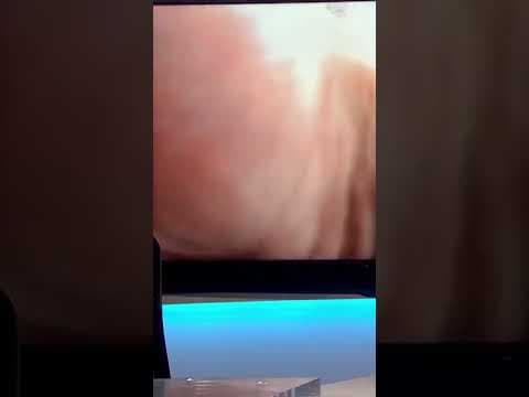 Deputy gets teens to surrender by barking like a dog