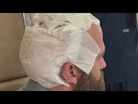 Medical tourism for cosmetic surgery is on the rise