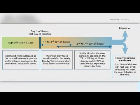 Health expert discusses causes, symptoms of E. coli