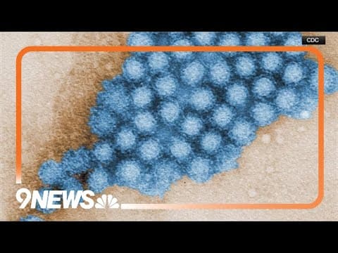 Colorado health officials tracking rise in norovirus outbreaks
