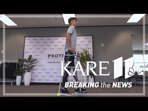 Ukrainian teen fitted with prosthetic