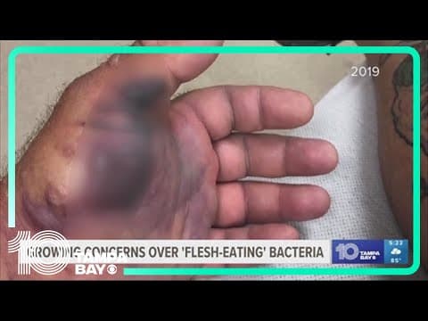 Growing concerns over 'flesh-eating' bacteria in Tampa Bay