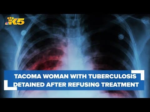 Tacoma woman with tuberculosis detained after refusing treatment