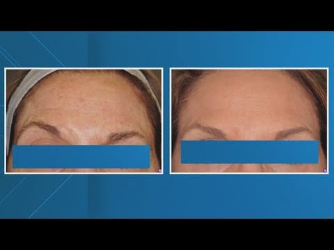 Louisiana Health Officials Warn Against Cheap Botox Alternatives