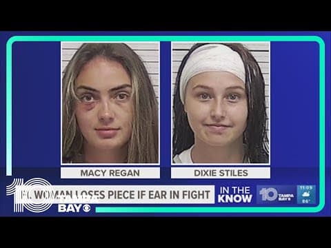 Florida woman loses ear over alleged stolen vape pens, alcohol