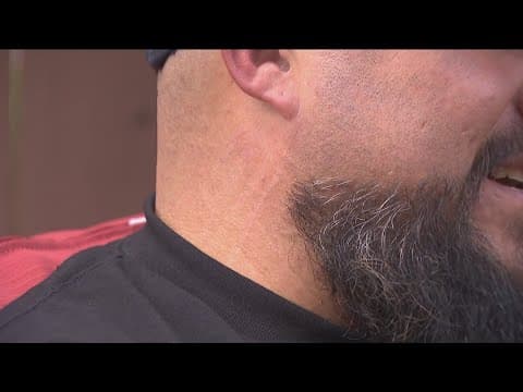 Free tattoo removal program relaunches for former gang members, human trafficking survivors