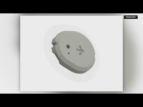 FDA approves first over-the-counter continuous glucose monitor for Type 2 diabetics