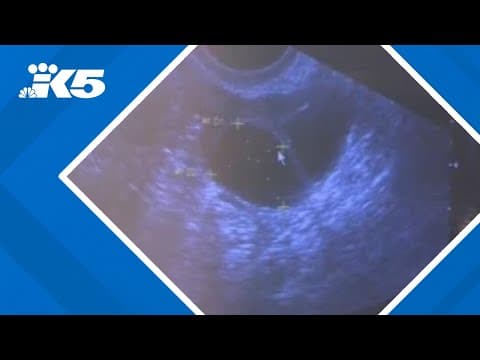 Would Washington's top gubernatorial candidates change abortion laws? We asked them