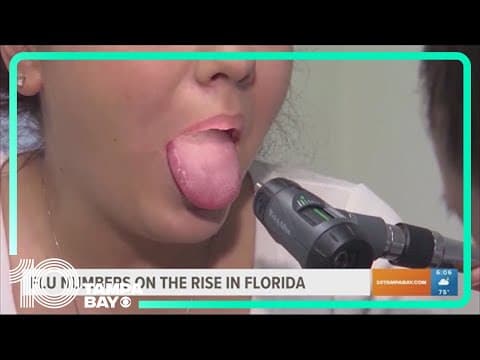 Doctors warn of rising flu cases in Florida