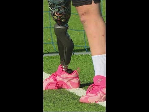 Fundraiser at Children's Museum of Indianapolis raises money for kids with limb loss