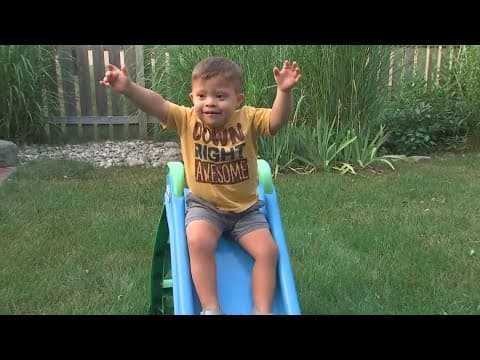 Breaking down barriers within the Down syndrome community