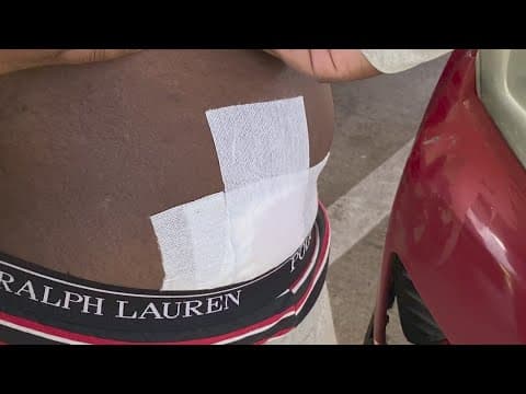 'Road rage is real' | Houston man shot during freeway merger left with a bullet in his side