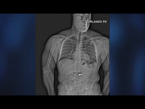 Florida man arrested after swallowing $795k diamond earrings