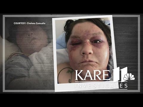 KARE 11 Investigates: Abuse victim left for dead says courts failed to protect her