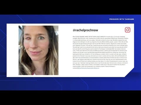 Parasite infection leaves Texas woman with cyborg-looking eye