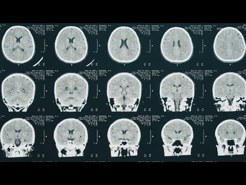 Recognizing the Signs: A Northshore Hospital Leads Effort in Alzheimer’s Awareness