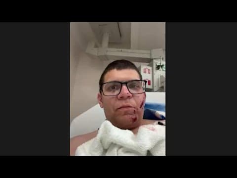 Extended interview: Victim recounts apparent road rage shooting on I-70 in Columbus