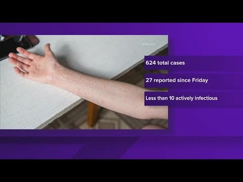 Measles continuing to climb in West Texas