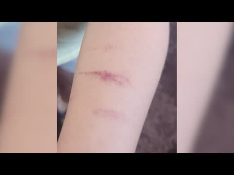 North Texas teacher accused of injuring elementary student