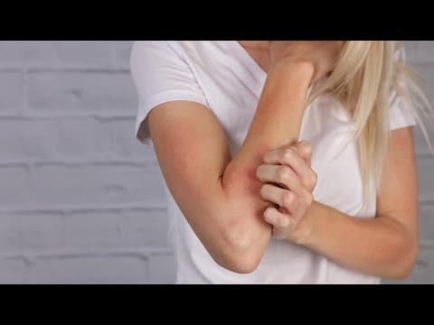 How to manage & control your eczema so you can enjoy summer