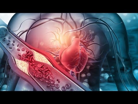 Fairfax Radiology uses Coronary CTA to detect disease early