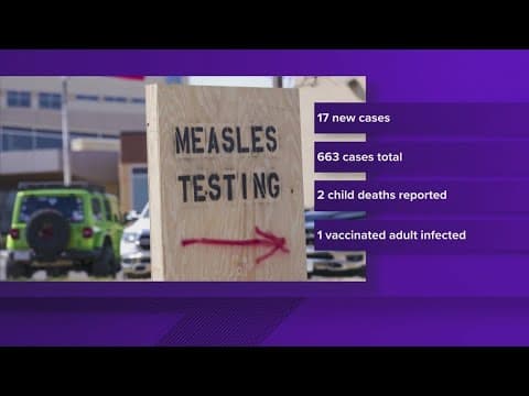 Texas Health Department confirms 17 new measles cases