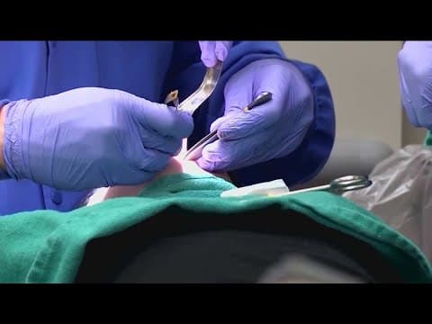 Routine dental visit spurs 8-day hospital stay in San Diego