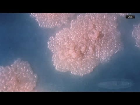 Kansas experiencing deadly tuberculosis outbreak