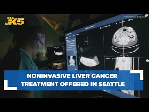 Noninvasive liver cancer treatment now offered in Seattle's First Hill: HealthLink
