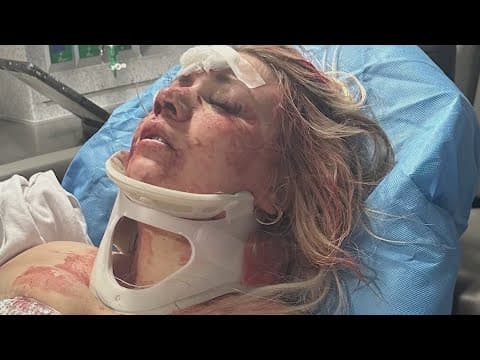 Bride-to-be says she was punched in the face by stranger during her Dallas bachelorette trip