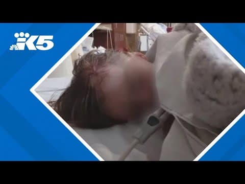 3-year-old attacked by black bear while camping