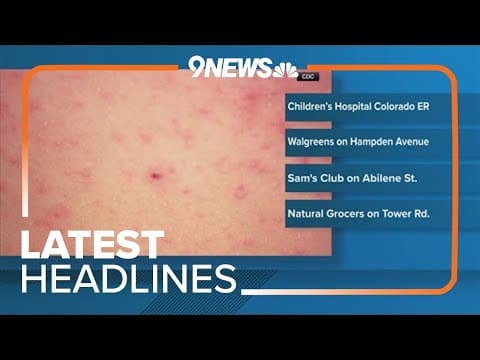 Latest Headlines | Measles case confirmed in Colorado toddler