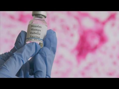 Doctors warn of potential measles surge as spring break travelers return to Ohio