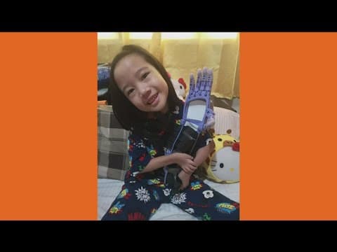 San Diego teen makes 3D printed custom prosthetic hand for 6-year-old in need in Philippines
