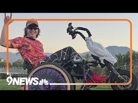 After an injury, DU student uses social media to inspire others facing similar challenges