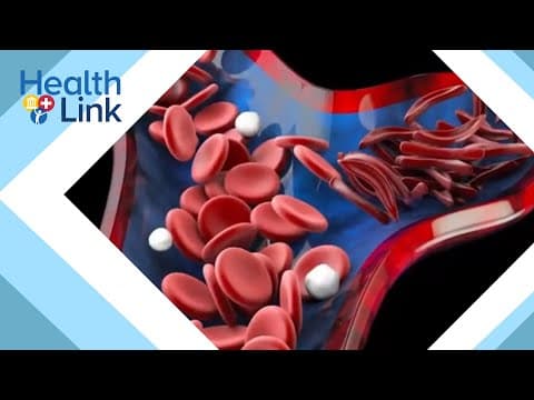 FDA approves gene editing technology to treat sickle cell disease: HealthLink