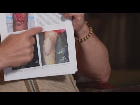 10Investigates: Surgery center faces lawsuits alleging bacterial infections from routine procedures