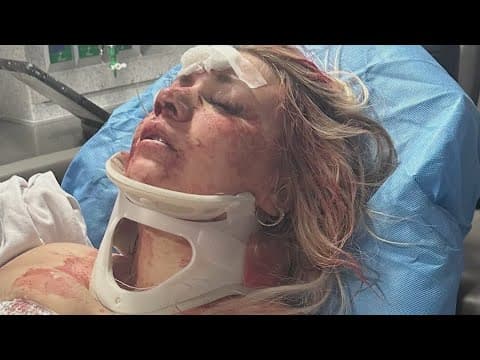 Dallas police identify suspect wanted for attacking Oklahoma woman on bachelorette trip